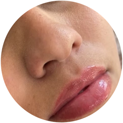 hidragloss-ilha-do-governador.jpg