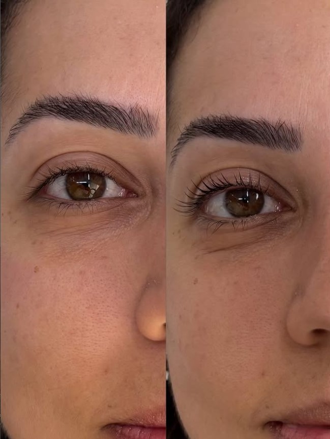 Lash Lifting dura quanto tempo? Veja cuidados