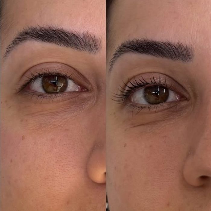 Lash Lifting dura quanto tempo? Veja cuidados